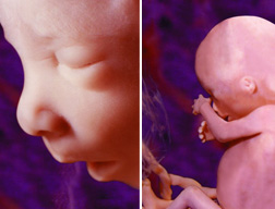 Fetal Development \u0026 Abortion \u00b7 First Coast Women\u002639;s Services